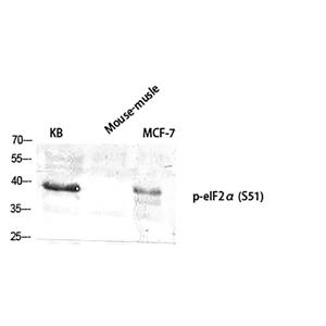 eIF2α (phospho Ser51)兔多抗,eIF2α (phospho Ser51) Rabbit Polyclonal Antibody