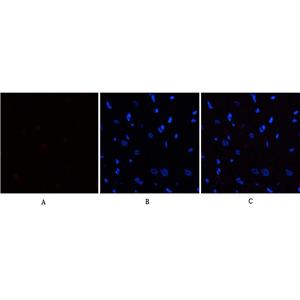 eIF2α (phospho Ser51)兔多抗,eIF2α (phospho Ser51) Rabbit Polyclonal Antibody
