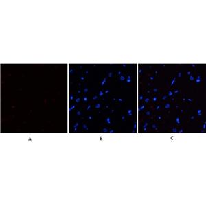 eIF2α (phospho Ser51)兔多抗,eIF2α (phospho Ser51) Rabbit Polyclonal Antibody