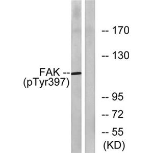 FAK (phospho Tyr397) Rabbit Polyclonal Antibody | 兔多抗 | EnkiLife恩玑生命