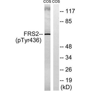 FRS2 (phospho Tyr436)兔多抗,FRS2 (phospho Tyr436) Rabbit Polyclonal Antibody
