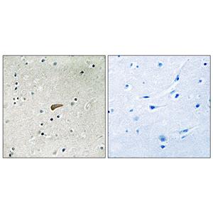FRS2 (phospho Tyr436)兔多抗,FRS2 (phospho Tyr436) Rabbit Polyclonal Antibody
