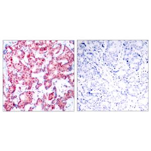 GATA-1 (phospho Ser142)兔多抗,GATA-1 (phospho Ser142) Rabbit Polyclonal Antibody