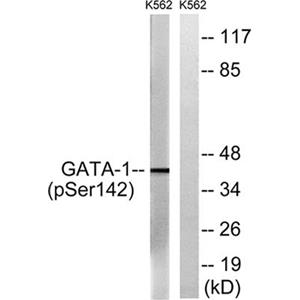 GATA-1 (phospho Ser142)兔多抗,GATA-1 (phospho Ser142) Rabbit Polyclonal Antibody