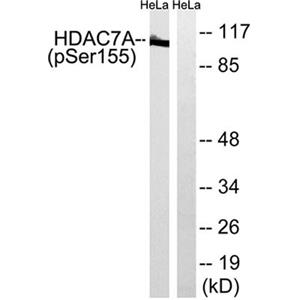 HDAC7 (phospho Ser155)兔多抗,HDAC7 (phospho Ser155) Rabbit Polyclonal Antibody