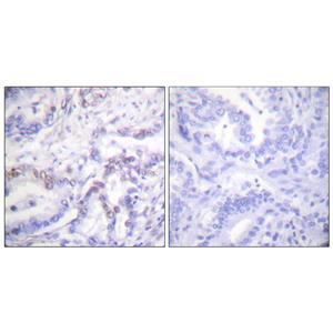 Histone H3 (phospho Thr3)兔多抗,Histone H3 (phospho Thr3) Rabbit Polyclonal Antibody