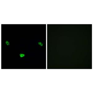 HNF4-α (phospho Ser313)兔多抗,HNF4-α (phospho Ser313) Rabbit Polyclonal Antibody