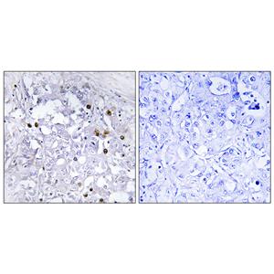 HNF4-α (phospho Ser313)兔多抗,HNF4-α (phospho Ser313) Rabbit Polyclonal Antibody