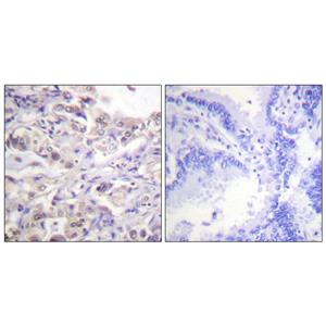 hnRNP D0 (phospho Ser83)兔多抗,hnRNP D0 (phospho Ser83) Rabbit Polyclonal Antibody