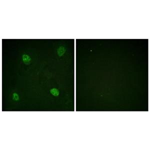 hnRNP D0 (phospho Ser83)兔多抗,hnRNP D0 (phospho Ser83) Rabbit Polyclonal Antibody