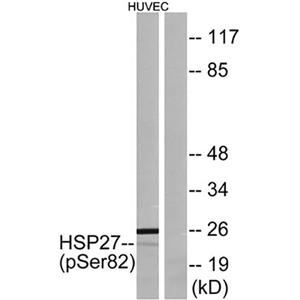 HSP27 (phospho Ser82)兔多抗,HSP27 (phospho Ser82) Rabbit Polyclonal Antibody