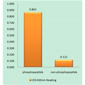 Integrin β1 (phospho Thr788)兔多抗,Integrin β1 (phospho Thr788) Rabbit Polyclonal Antibody