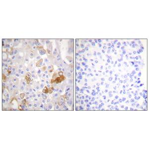 Integrin β1 (phospho Thr788)兔多抗,Integrin β1 (phospho Thr788) Rabbit Polyclonal Antibody