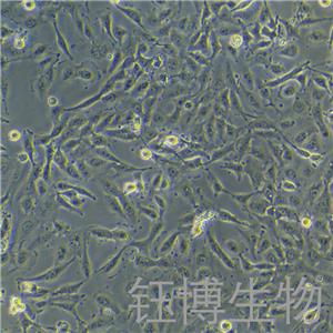 FTC238（人滤泡状甲状腺癌细胞，肺转移）YB-72024HC