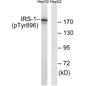 IRS-1 (phospho Tyr896)兔多抗,IRS-1 (phospho Tyr896) Rabbit Polyclonal Antibody