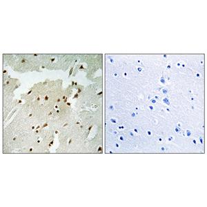 Ku-70 (phospho Ser5)兔多抗,Ku-70 (phospho Ser5) Rabbit Polyclonal Antibody