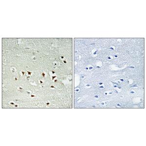 MAPKAPK-2 (phospho Thr334)兔多抗,MAPKAPK-2 (phospho Thr334) Rabbit Polyclonal Antibody