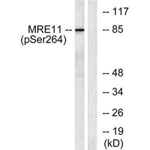 MRE11 (phospho Ser264)兔多抗,MRE11 (phospho Ser264) Rabbit Polyclonal Antibody