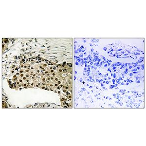 MSK1 (phospho Ser212)兔多抗,MSK1 (phospho Ser212) Rabbit Polyclonal Antibody