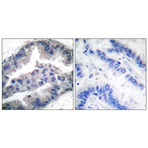 NBK (phospho Thr33)兔多抗,NBK (phospho Thr33) Rabbit Polyclonal Antibody