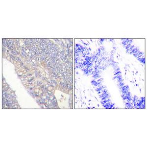 NBK (phospho Thr33)兔多抗,NBK (phospho Thr33) Rabbit Polyclonal Antibody