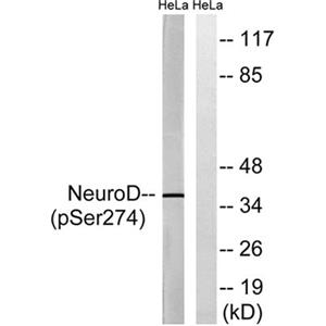 Neuro D (phospho Ser274)兔多抗,Neuro D (phospho Ser274) Rabbit Polyclonal Antibody