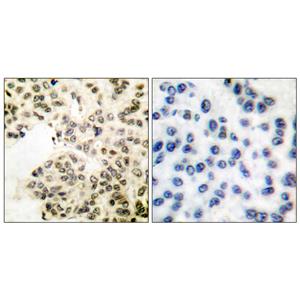 NFκB-p65 (phospho Ser311)兔多抗,NFκB-p65 (phospho Ser311) Rabbit Polyclonal Antibody