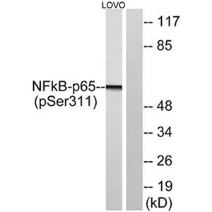 NFκB-p65 (phospho Ser311)兔多抗,NFκB-p65 (phospho Ser311) Rabbit Polyclonal Antibody