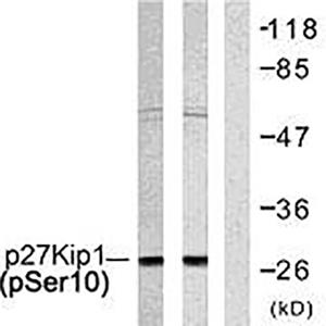 p27 (phospho Ser10)兔多抗,p27 (phospho Ser10) Rabbit Polyclonal Antibody