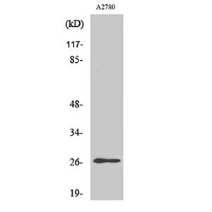 p27 (phospho Ser10)兔多抗,p27 (phospho Ser10) Rabbit Polyclonal Antibody