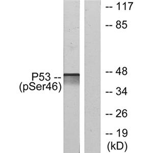 p53 (phospho Ser46)兔多抗,p53 (phospho Ser46) Rabbit Polyclonal Antibody