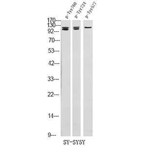 FGFR3 (Phospho-Tyr724)兔多抗,FGFR3 (Phospho-Tyr724) Rabbit Polyclonal Antibody