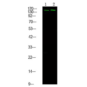 NCoA3 (Phospho-Ser857)兔多抗,NCoA3 (Phospho-Ser857) Rabbit Polyclonal Antibody