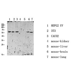 RIPK2 (Phospho-Ser176)兔多抗,RIPK2 (Phospho-Ser176) Rabbit Polyclonal Antibody