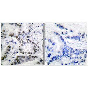 CBP (Acetyl Lys1535)兔多抗,CBP (Acetyl Lys1535) Rabbit Polyclonal Antibody