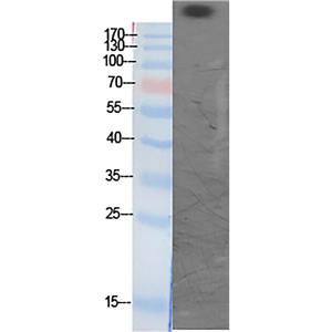 CBP (Acetyl Lys1535)兔多抗,CBP (Acetyl Lys1535) Rabbit Polyclonal Antibody