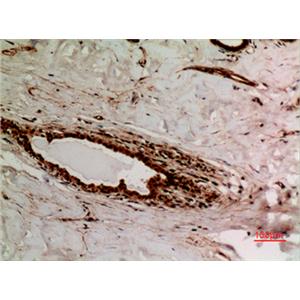 Ku-70 (Acetyl Lys539)兔多抗,Ku-70 (Acetyl Lys539) Rabbit Polyclonal Antibody