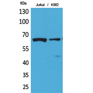 NFκB-p65 (Acetyl Lys218)兔多抗,NFκB-p65 (Acetyl Lys218) Rabbit Polyclonal Antibody