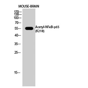 NFκB-p65 (Acetyl Lys218)兔多抗,NFκB-p65 (Acetyl Lys218) Rabbit Polyclonal Antibody