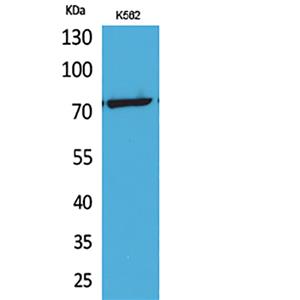 p73 (Acetyl Lys321)兔多抗,p73 (Acetyl Lys321) Rabbit Polyclonal Antibody