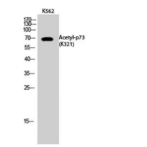p73 (Acetyl Lys321)兔多抗,p73 (Acetyl Lys321) Rabbit Polyclonal Antibody