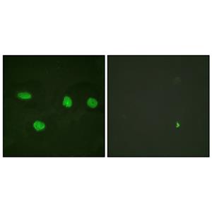 53BP1兔多抗,53BP1 Rabbit Polyclonal Antibody