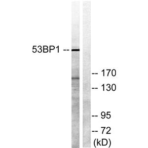 53BP1兔多抗,53BP1 Rabbit Polyclonal Antibody