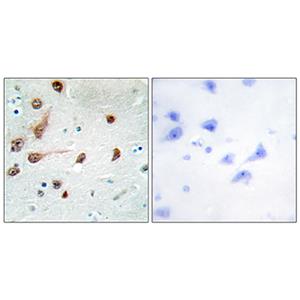 ADAR1兔多抗,ADAR1 Rabbit Polyclonal Antibody