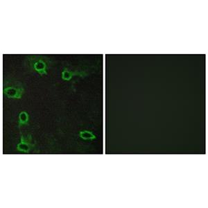 Adenosine A2A-R兔多抗,Adenosine A2A-R Rabbit Polyclonal Antibody