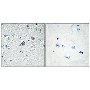 Adenosine A2A-R兔多抗,Adenosine A2A-R Rabbit Polyclonal Antibody