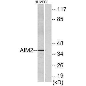 AIM2兔多抗,AIM2 Rabbit Polyclonal Antibody