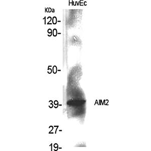 AIM2兔多抗,AIM2 Rabbit Polyclonal Antibody