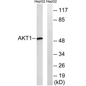 Akt1兔多抗,Akt1 Rabbit Polyclonal Antibody