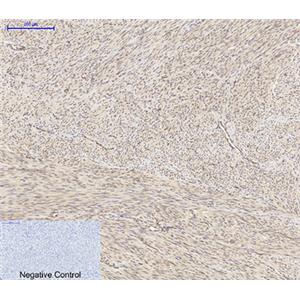 Akt1兔多抗,Akt1 Rabbit Polyclonal Antibody